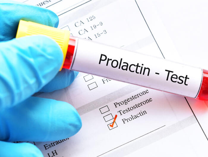 prolacitin test image